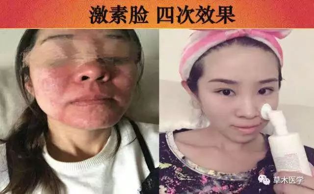 【草木医学】便秘一招灵！副作用是过敏 口臭 胃胀 口腔溃疡好了...