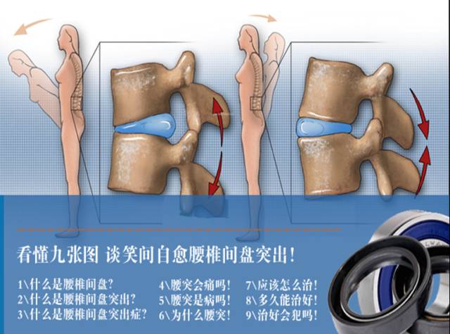 草木医学 9毫米腰椎间盘突出症 腰痛腿麻木 椎管狭窄诊断与治疗！