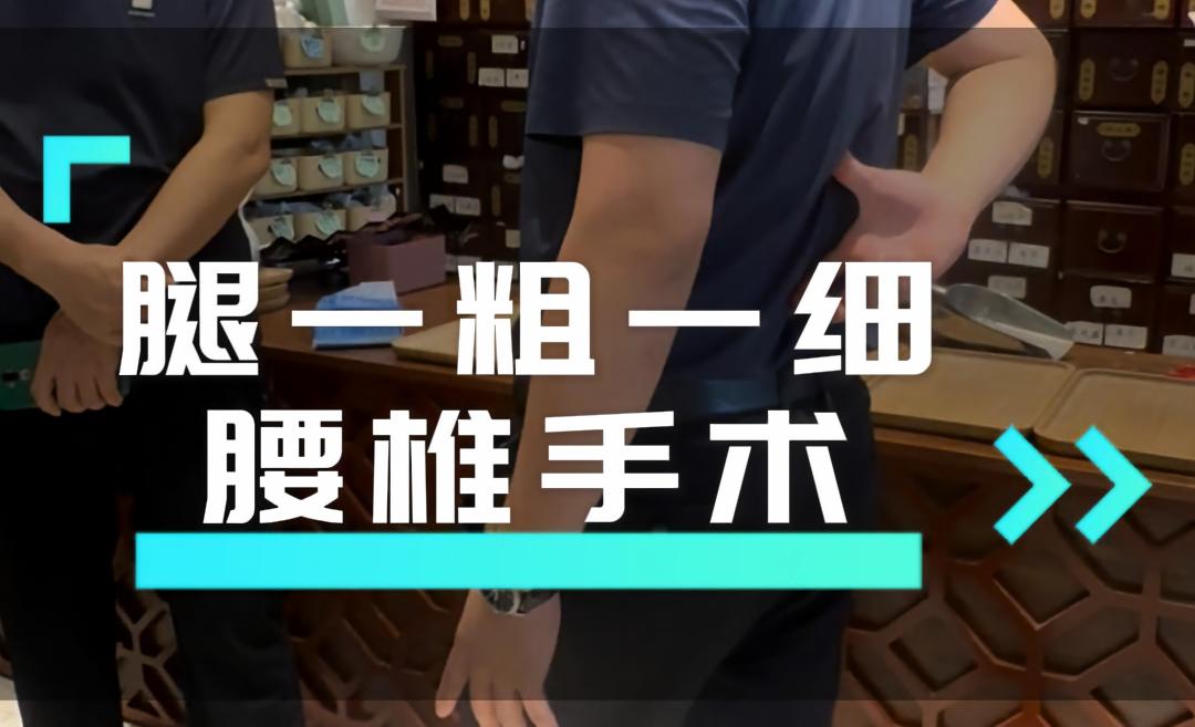 腰椎手术 腿一粗一细
